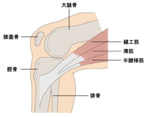 鵞足炎の原因やメカニズムを解説する図。過度な運動や筋肉の緊張が影響を与えることを示す。