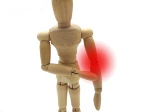 打撲のイメージ図