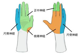 頸椎から腕・指先にかけての神経走行としびれの原因を示す図解